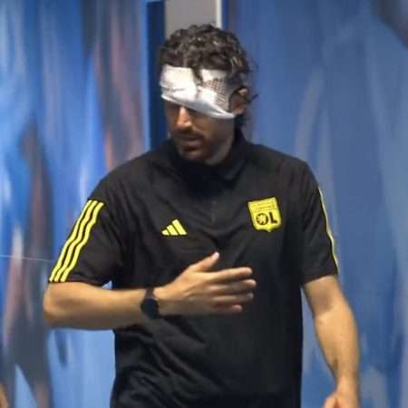 Kuva: Lyonin valmentajan naama kivitettiin verille, ottelu peruutettiin